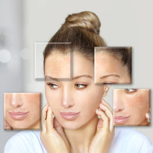 Hydra Facial​